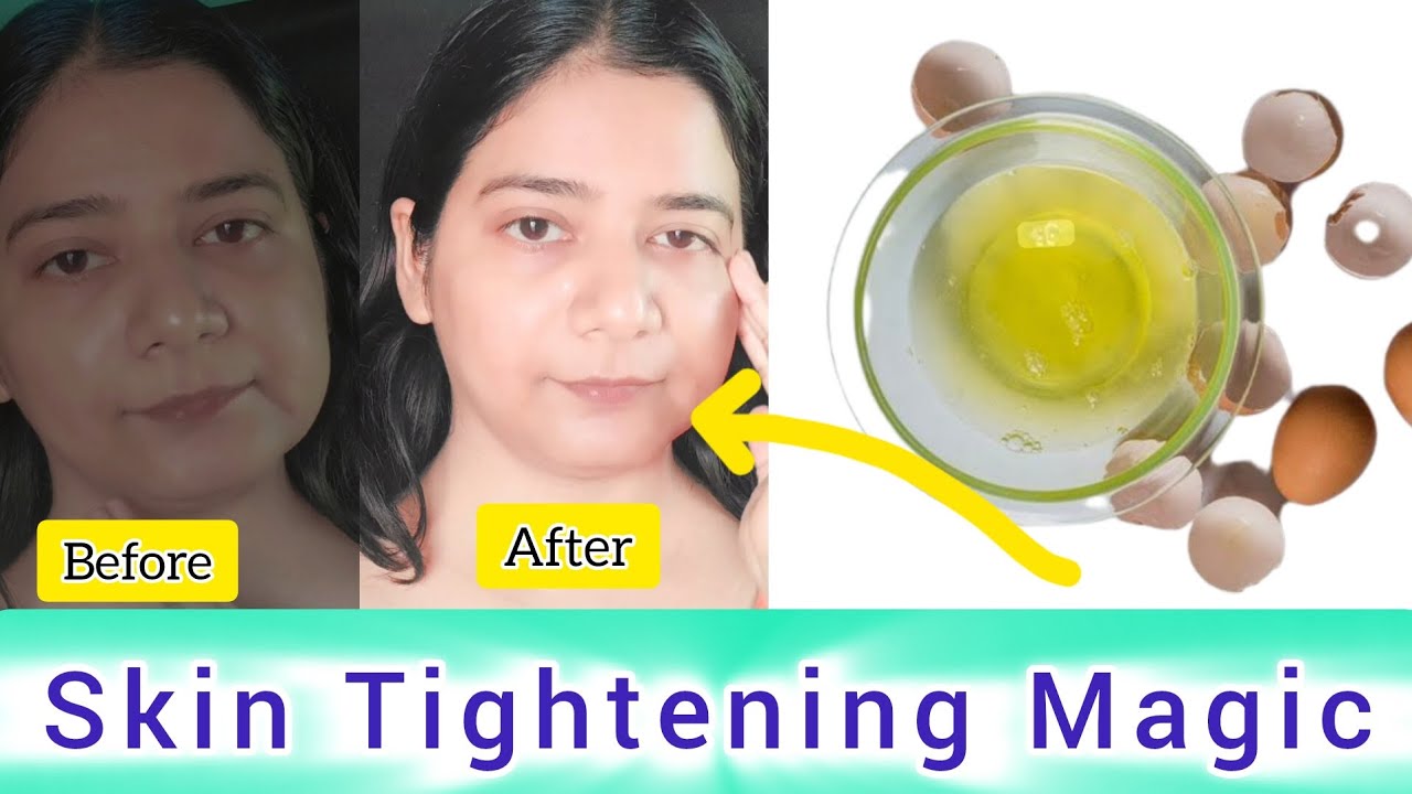 Skin Tightening Magic: Egg White and Raw Milk Face Pack for Glowing Skin!