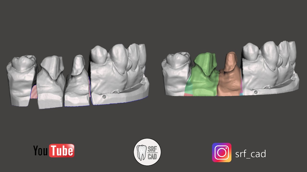 MESHMIXER DENTAL: Come creare un modello stampabile da scanner da banco MODEL CREATOR FROM DESK SCAN