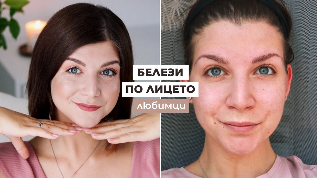 Как Сама Изчистих Белезите по Лицето си? | Любими Продукти