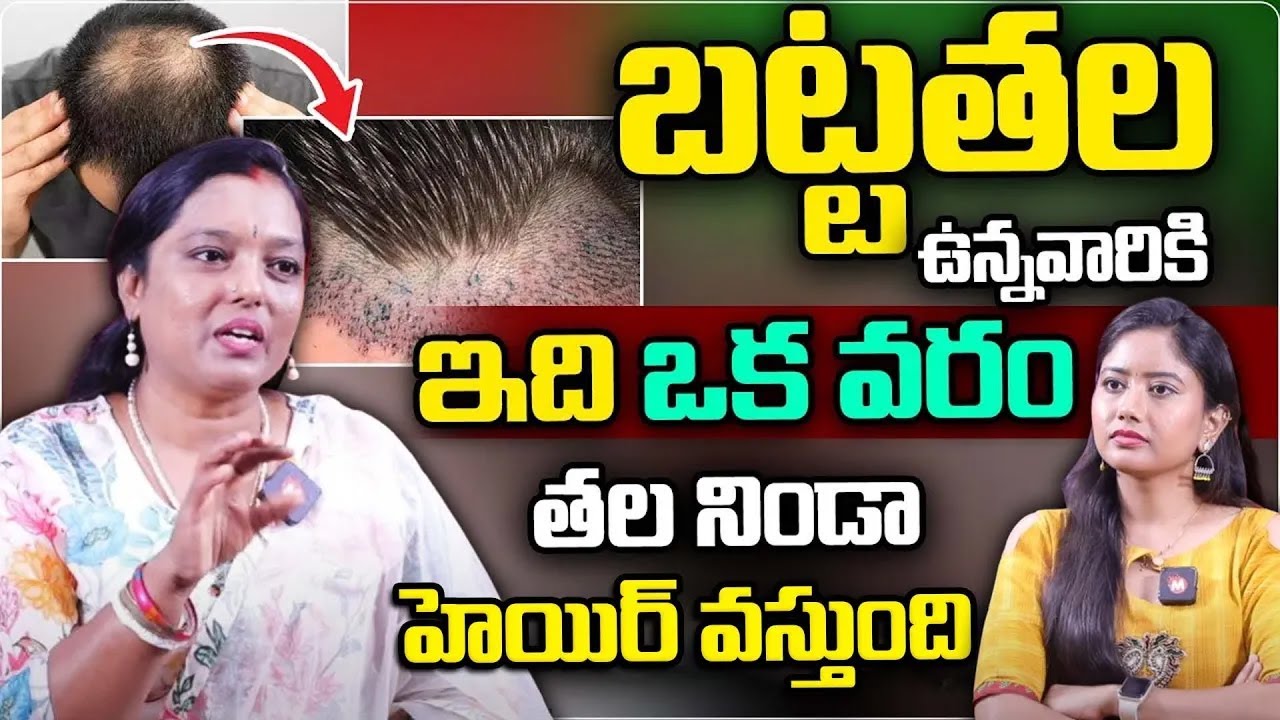 బట్టతల ఉన్నవారికి ఇది ఒక వరం | Best Treatment | Vijaya Lakshmi | Bald Head | 