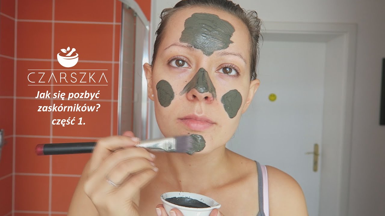 Jak się pozbyć zaskórników? część 1 - Czarszka -