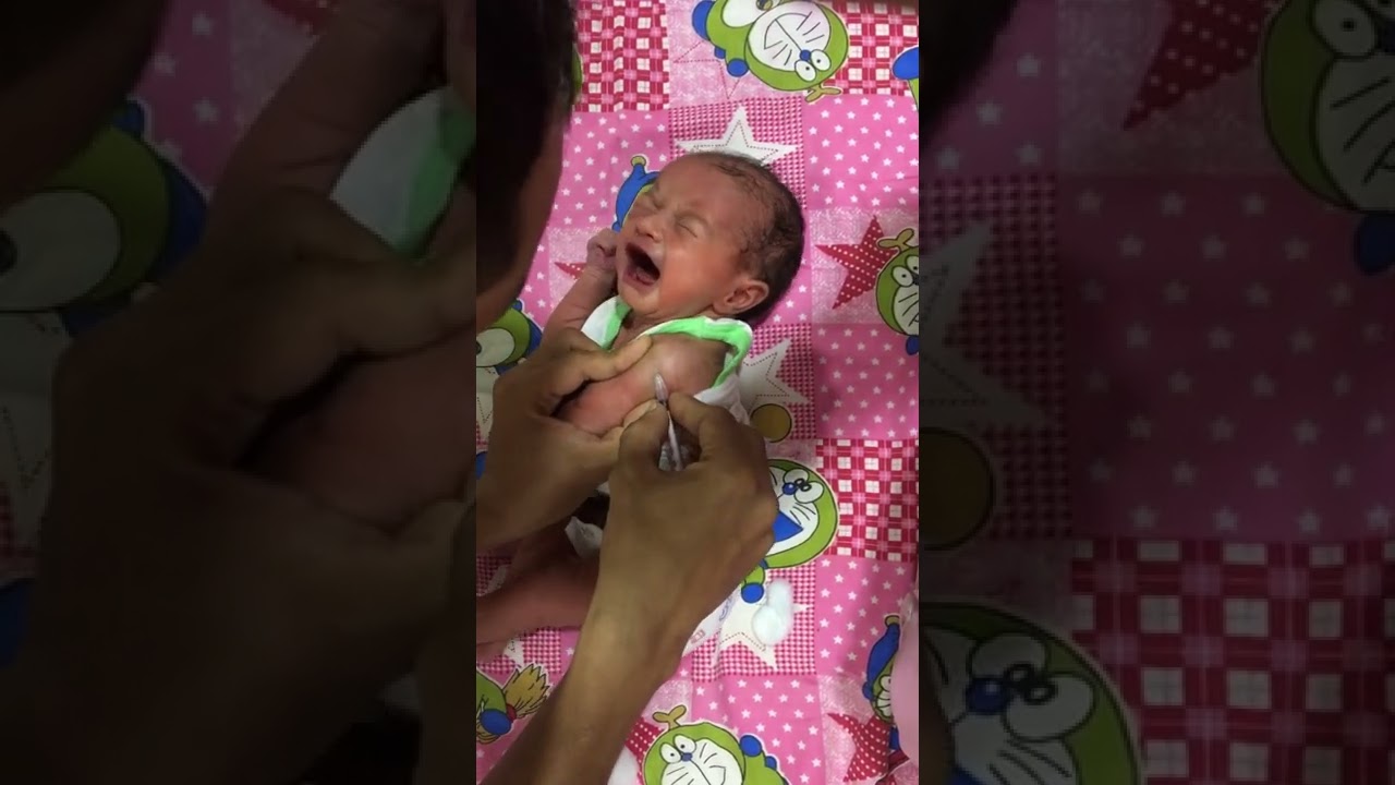 New born baby B c g vaccination
