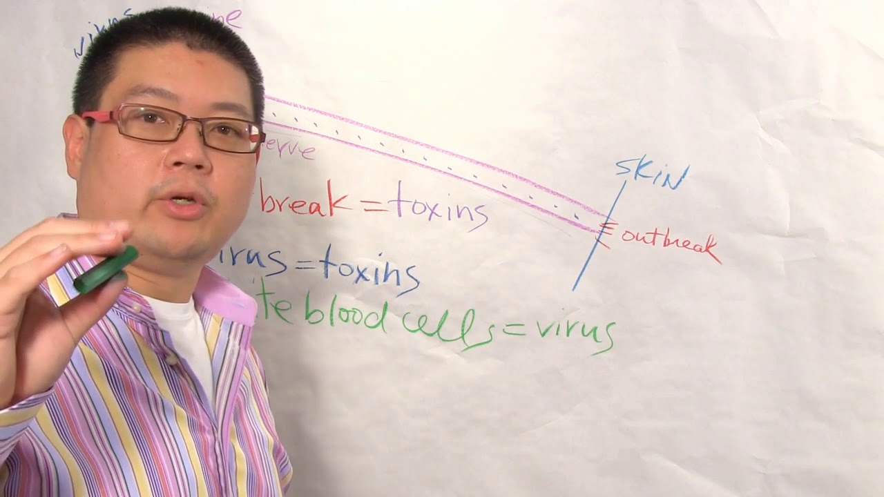 How To Get Rid of Herpes outbreak overnight
