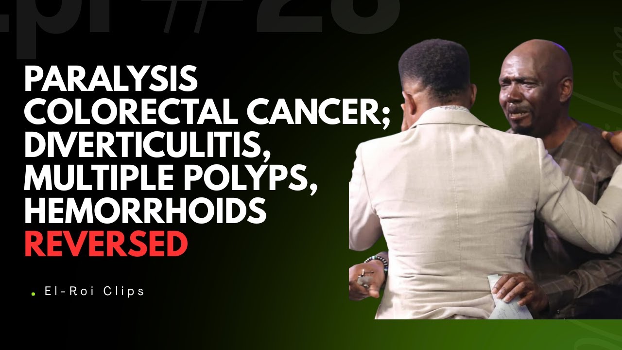 PARALYSIS COLORECTAL CANCER; DIVERTICULITIS, MULTIPLE POLYPS, HEMORRHOIDS REVERSED