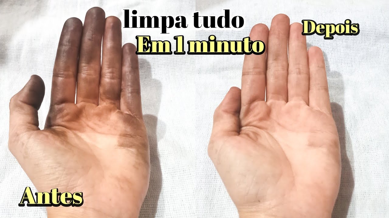 COMO TIRAR TINTA DE CABELO DA MÃO FÁCIL