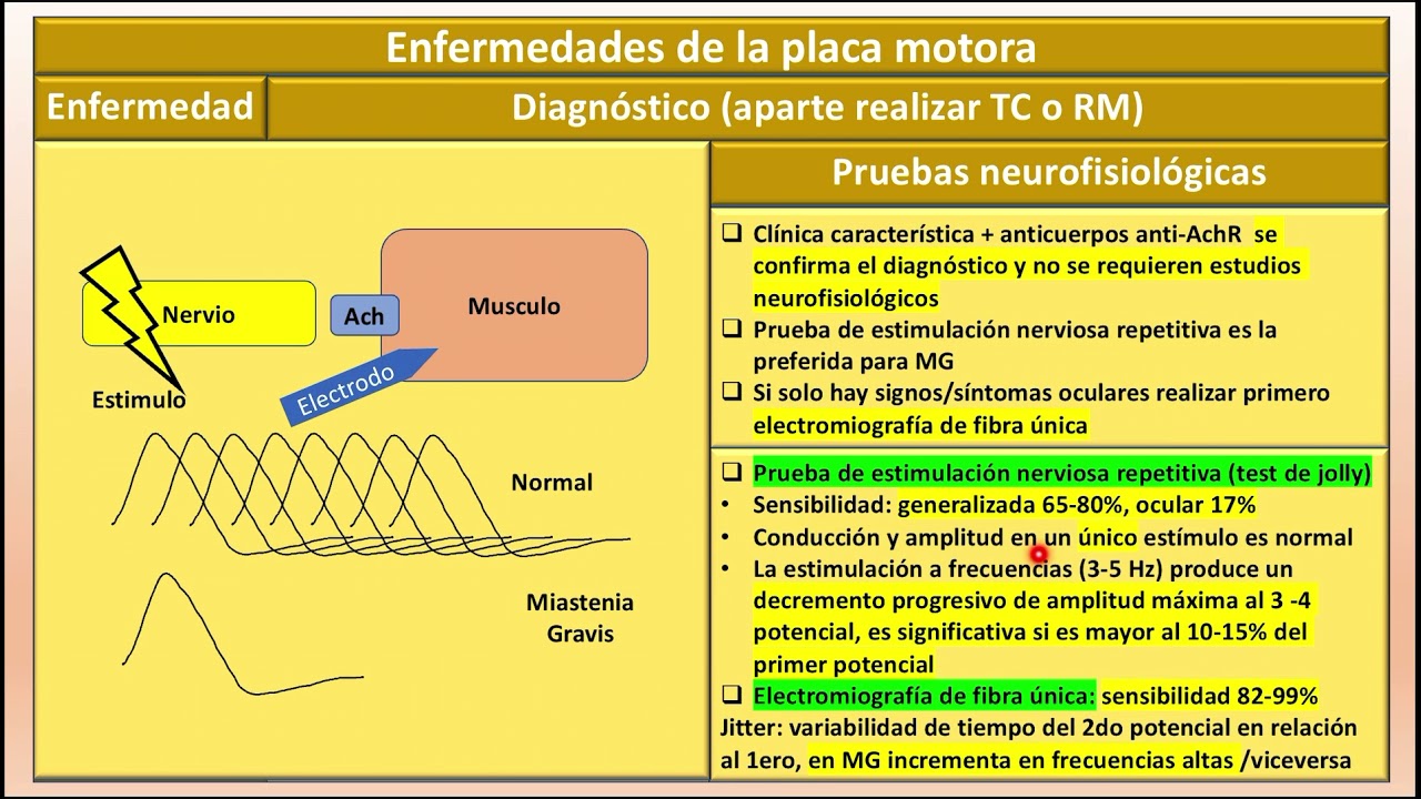 Enfermedades de la placa motora: MIASTENIA GRAVIS vs EATON LAMBERT vs BOTULISMO #enarm