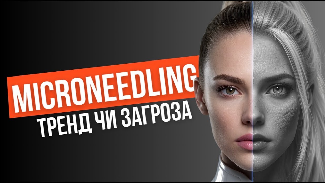 БУМ НА МІКРОНІДЛІНГ,тренд чи загроза?Відверта розмова про результативність,ризики та міфи