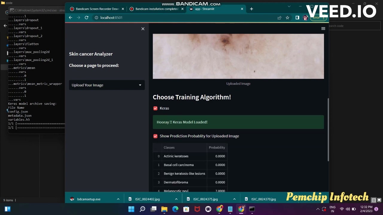 Skin Disease Prediction using Machine learning