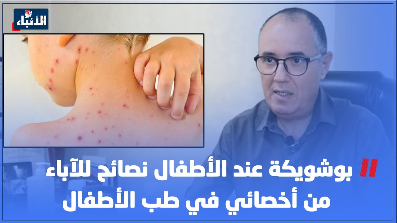 بوشويكة عند الأطفال نصائح للآباء من أخصائي في طب الأطفال