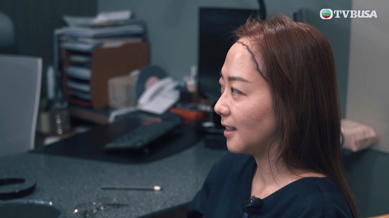 醫美直擊 首爾篇｜不滿自己額頭偏高，決定植髮；院長卻建議先往染髮？｜何依婷｜韓國｜醫美｜額頭偏高｜植髮｜