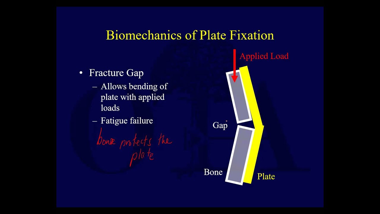 Ортопедические имплантаты 1