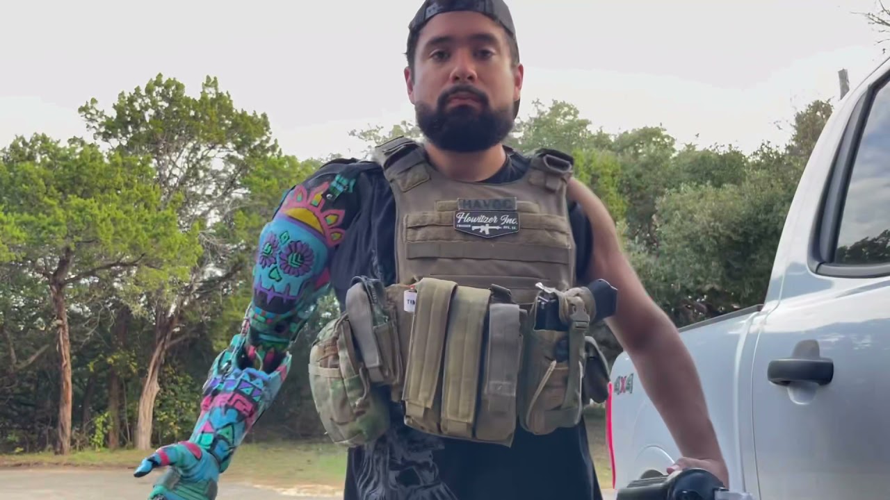 My Hybrid Prosthetic Arm