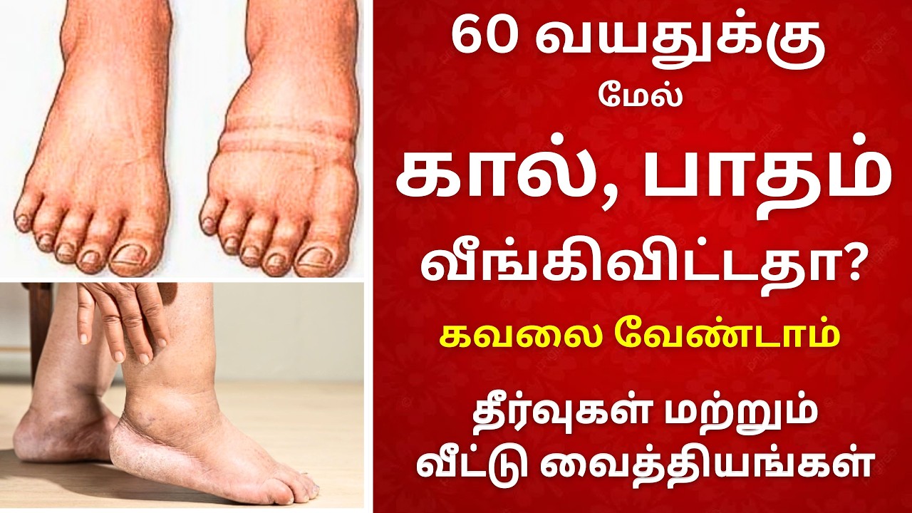 60 வயசுக்கு மேல் வரும் கால் மற்றும் பாதம் வீக்கம் | Home Remedy for Swollen Legs | Senior Citizens 
