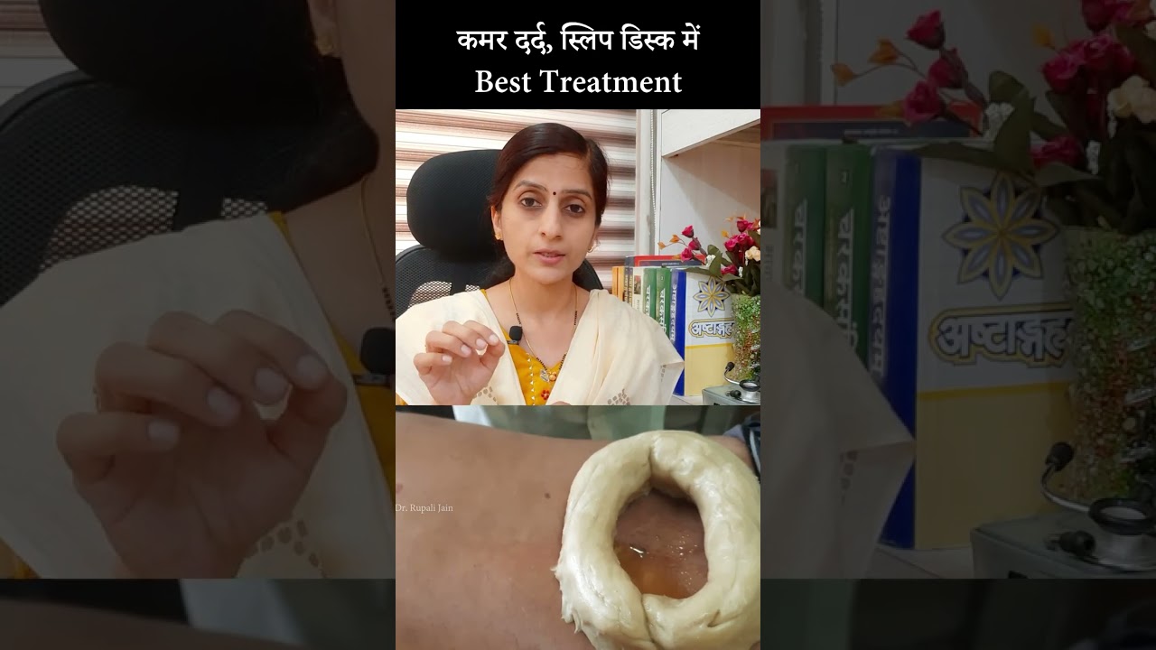 Best Ayurvedic Treatment for Slip Disc-Lumbar Spondylosis || कमरदर्द- आयुर्वेदिक इलाज