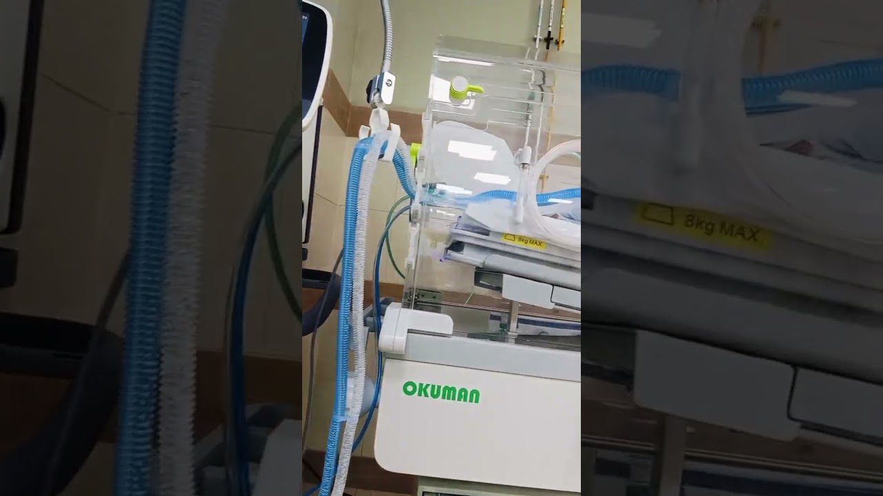 Preterm Baby on Ventilator | 0.78 kg Baby Struggling to Breathe | NICU Real Life