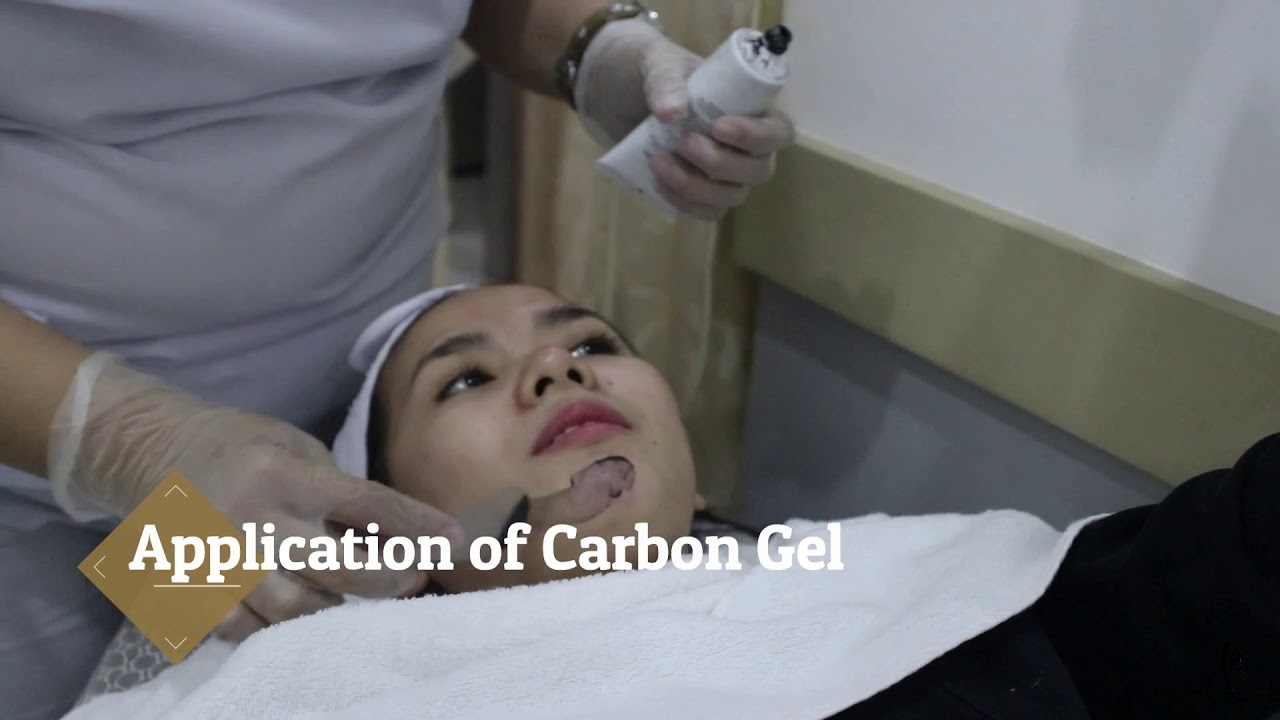 Celebrity vlogger tries Medicalia acne facial with carbon laser peel