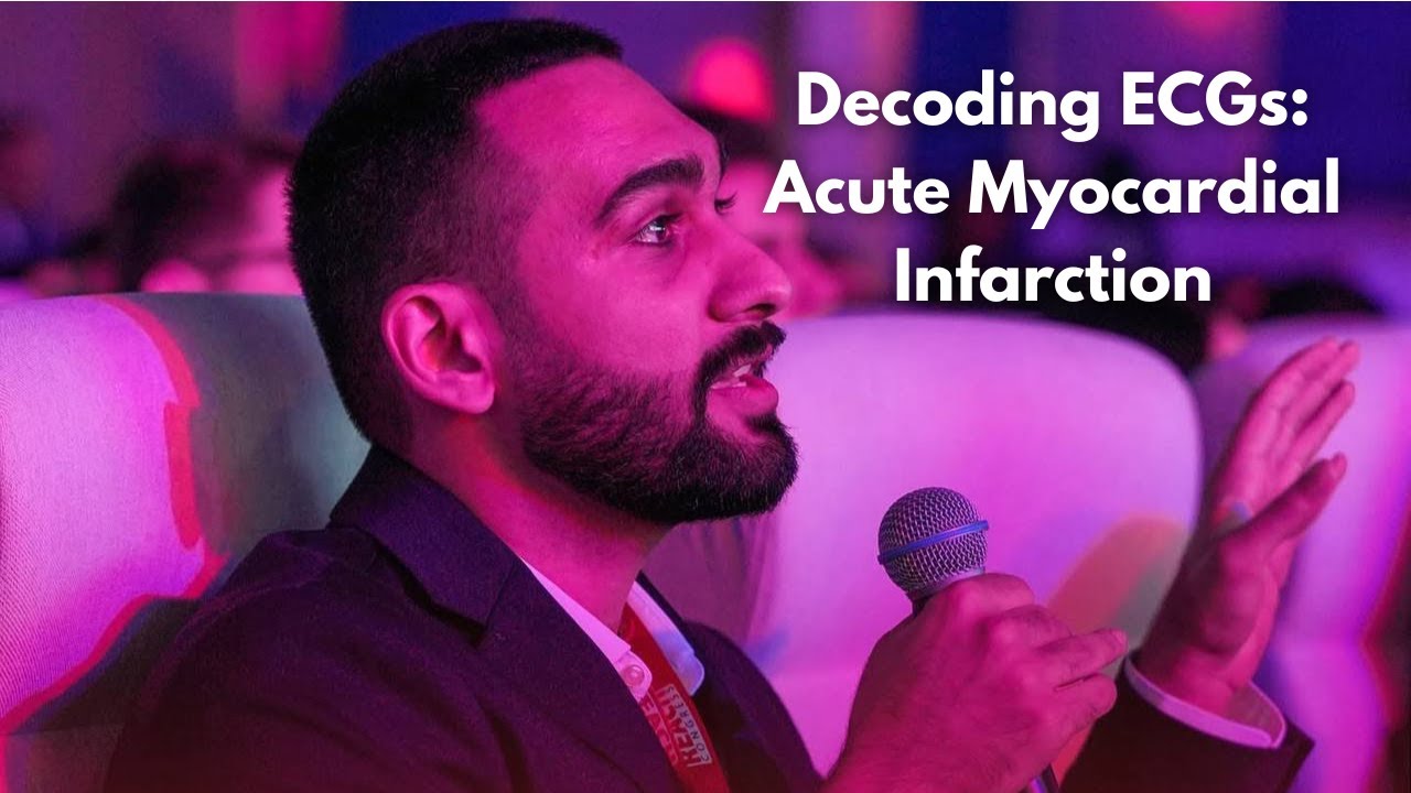 Decoding ECGs: Identifying AMI & Culprit Vessels (Explained)