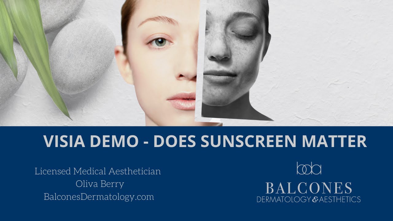 VISIA Demo - Does Sunscreen Matter | Austin, TX | Ph: 512-459-4869