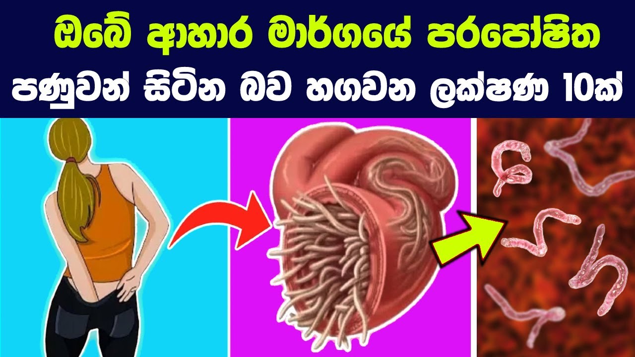ඔබේ ආහාර මාර්ගයේ පරපෝෂිත පණුවන් සිටින බව හගවන ලක්ෂණ 10ක් | Parasitic Worm Infections