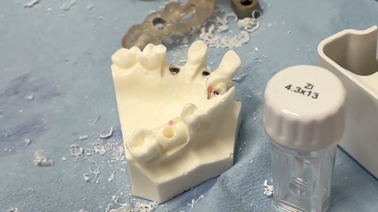 Zirconia Implant 2 piece - guide placement Neodent