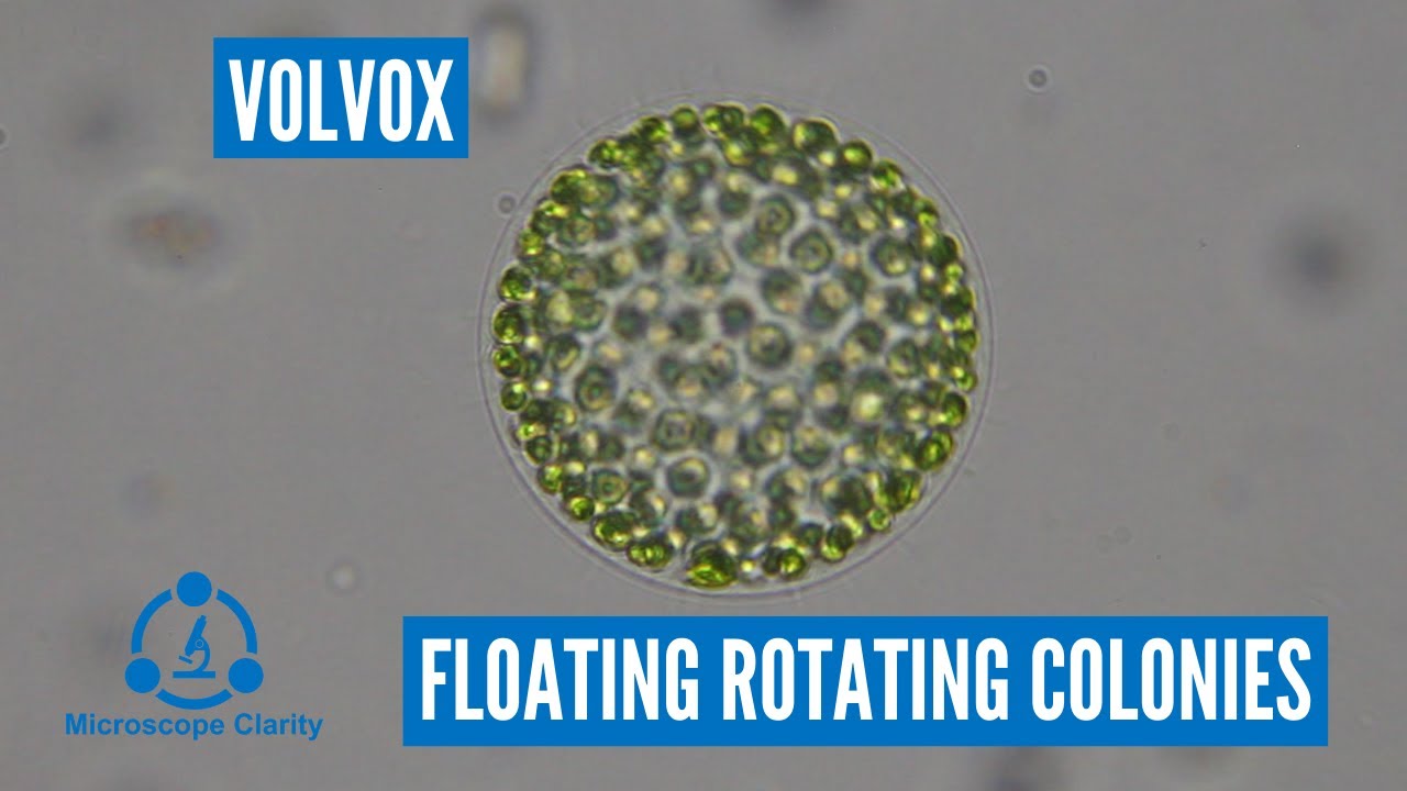 Volvox under a microscope