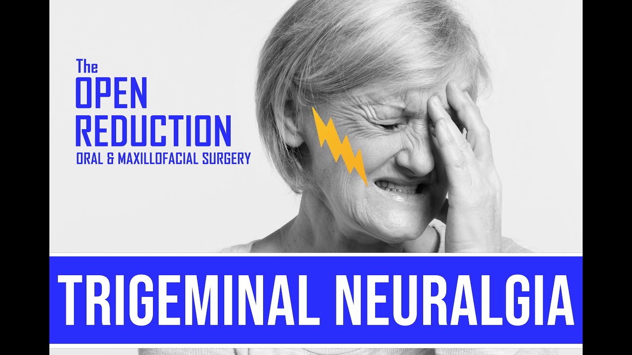 TRIGEMINAL NEURALGIA | HOW TO EVALUATE AND TREAT