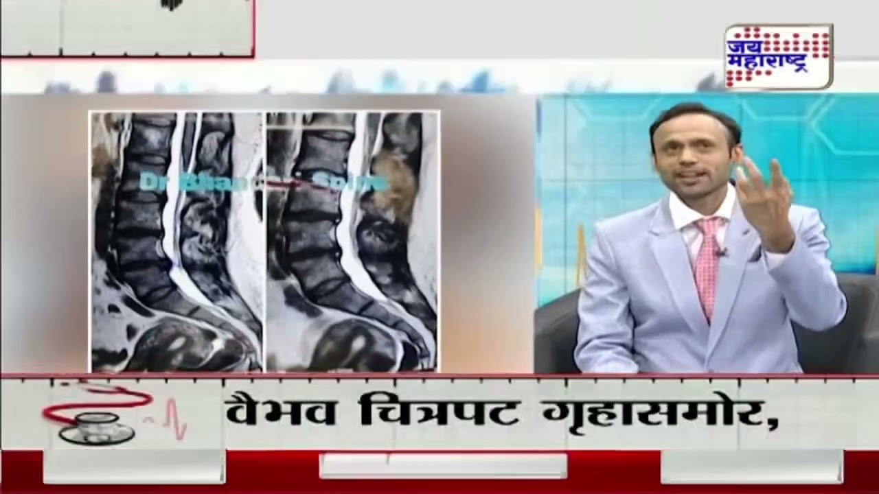 मणक्याचे ऑपरेशन कसे टाळाल ? Spine Pain Without Pain Block & Operation | Chiropractor | आयुर्वेद