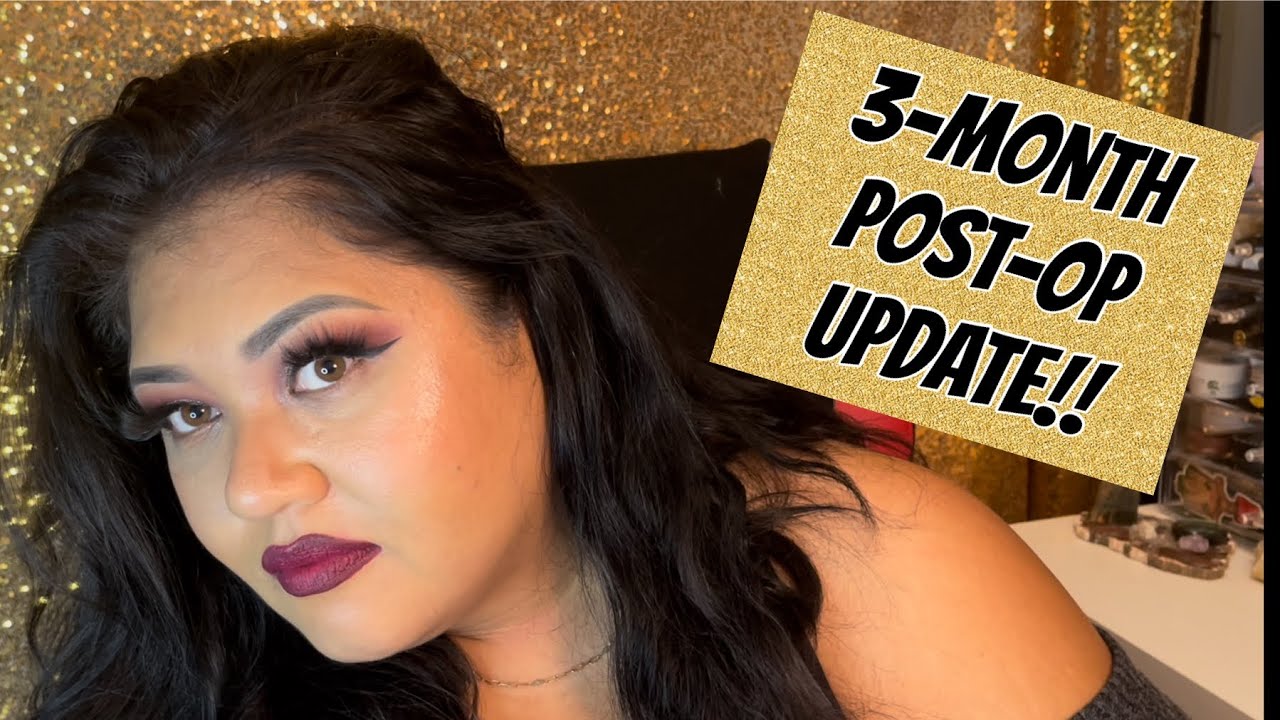 Gastric Bypass: 3-Month Post-Op Update | Weight Check, Diet, and Mental Health