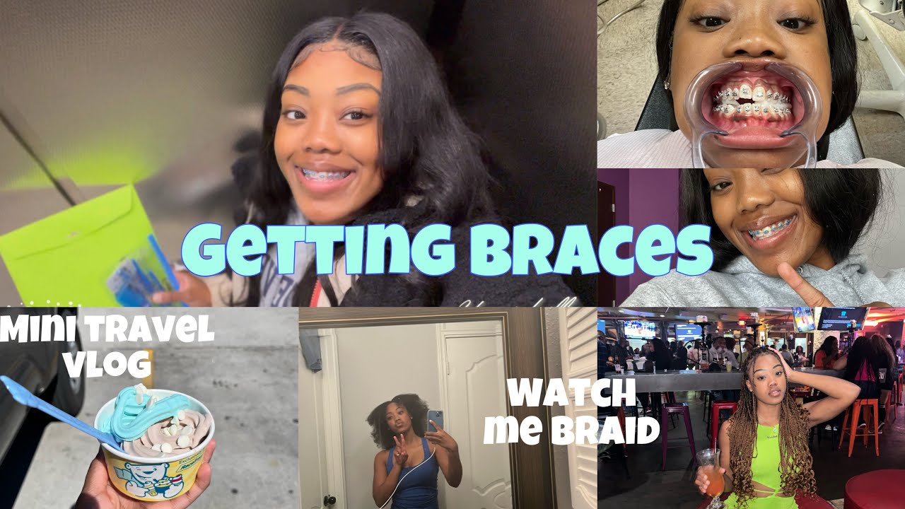Пойдем со мной, чтобы поставить брекеты 💓Мини-блог «Как я иду домой и заплетаю косы»