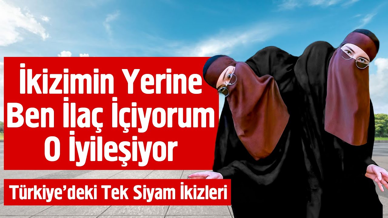 İkizimin Yerine Ben İlaç İçiyorum O İyileşiyor - Siyam İkizleri