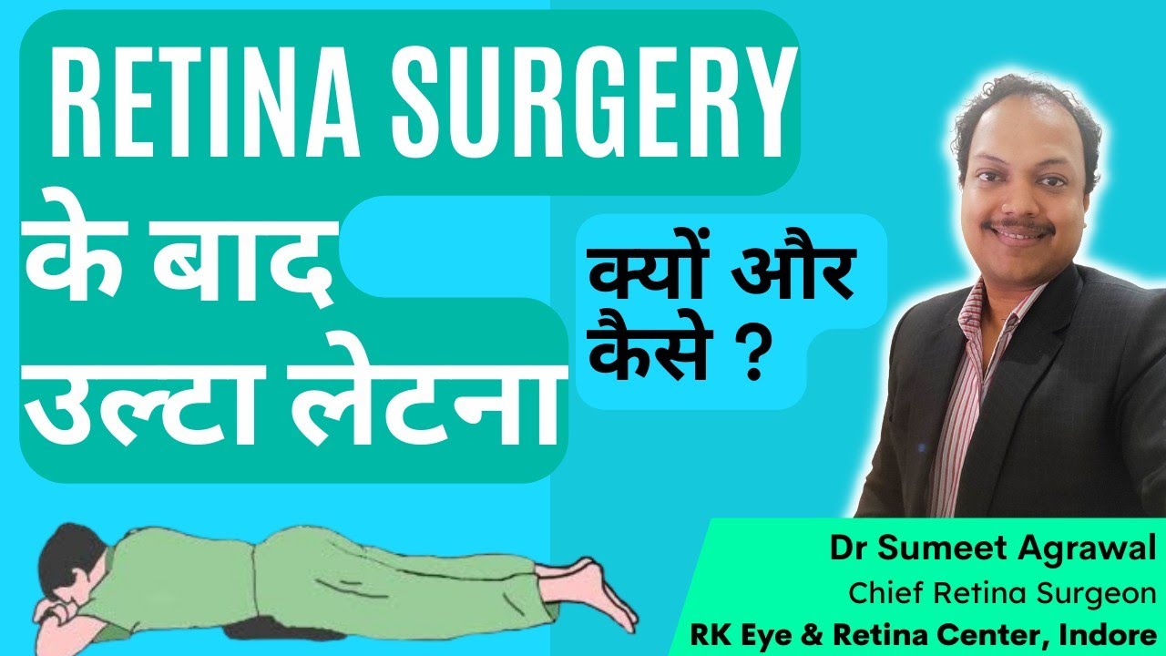 Retina surgery के बाद उल्टा लेटना । क्यों और कैसे ?