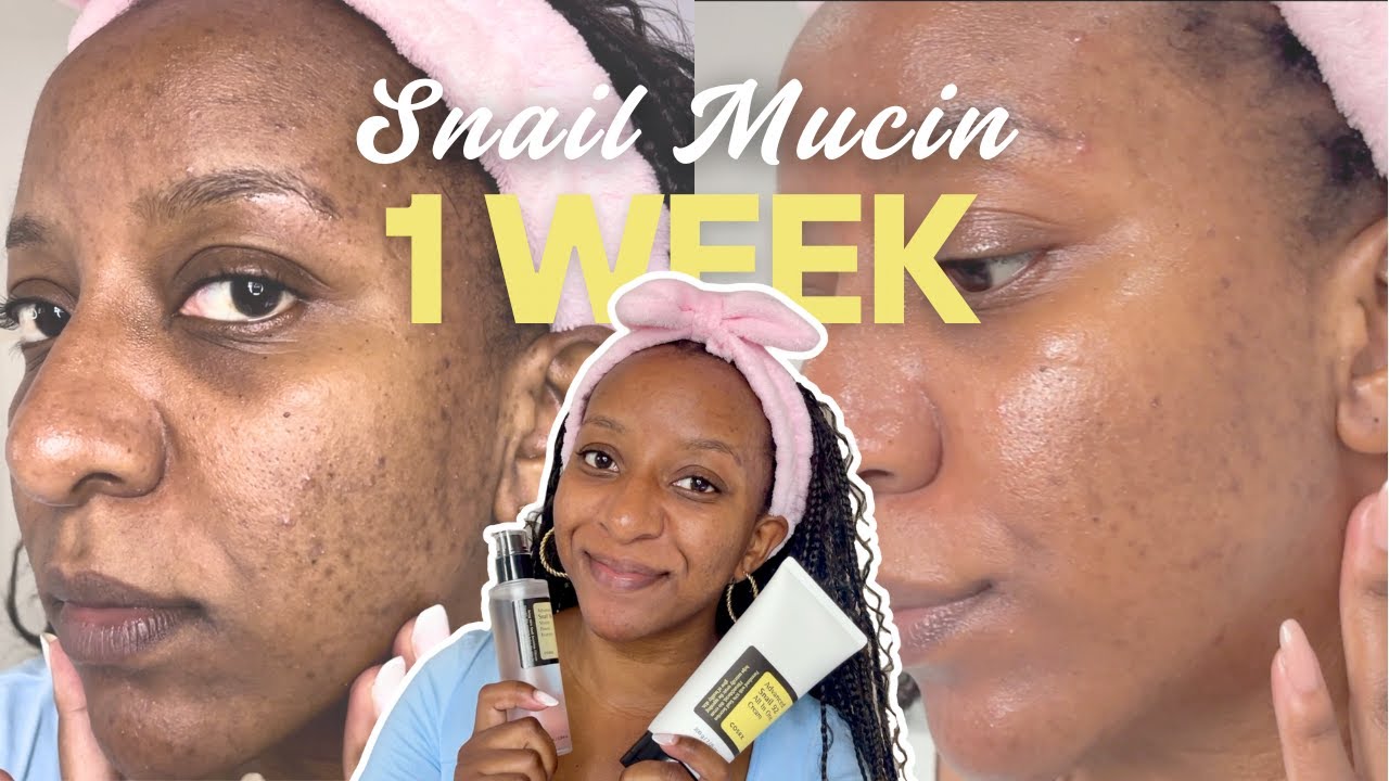 I Tested COSRX Snail Mucin for 7 Days! (results to realistically expect with hyperpigmentation)