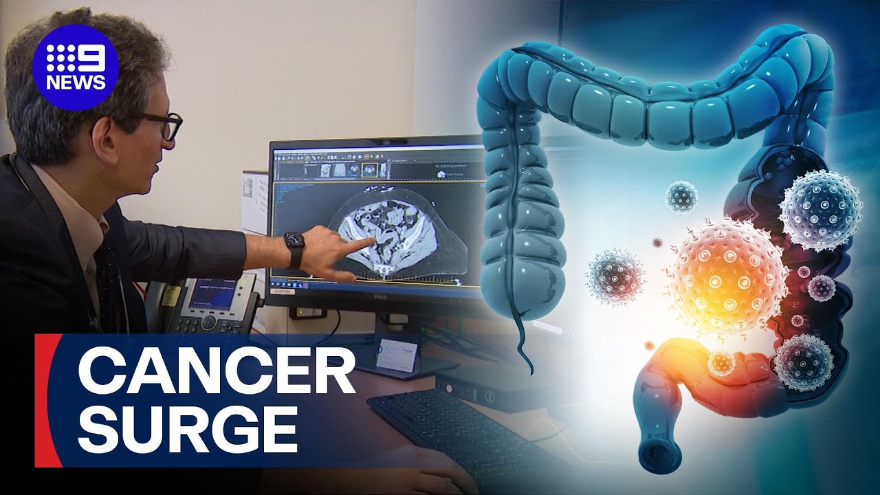 Could diet be linked to a boom in bowel cancer cases? | 9 News Australia