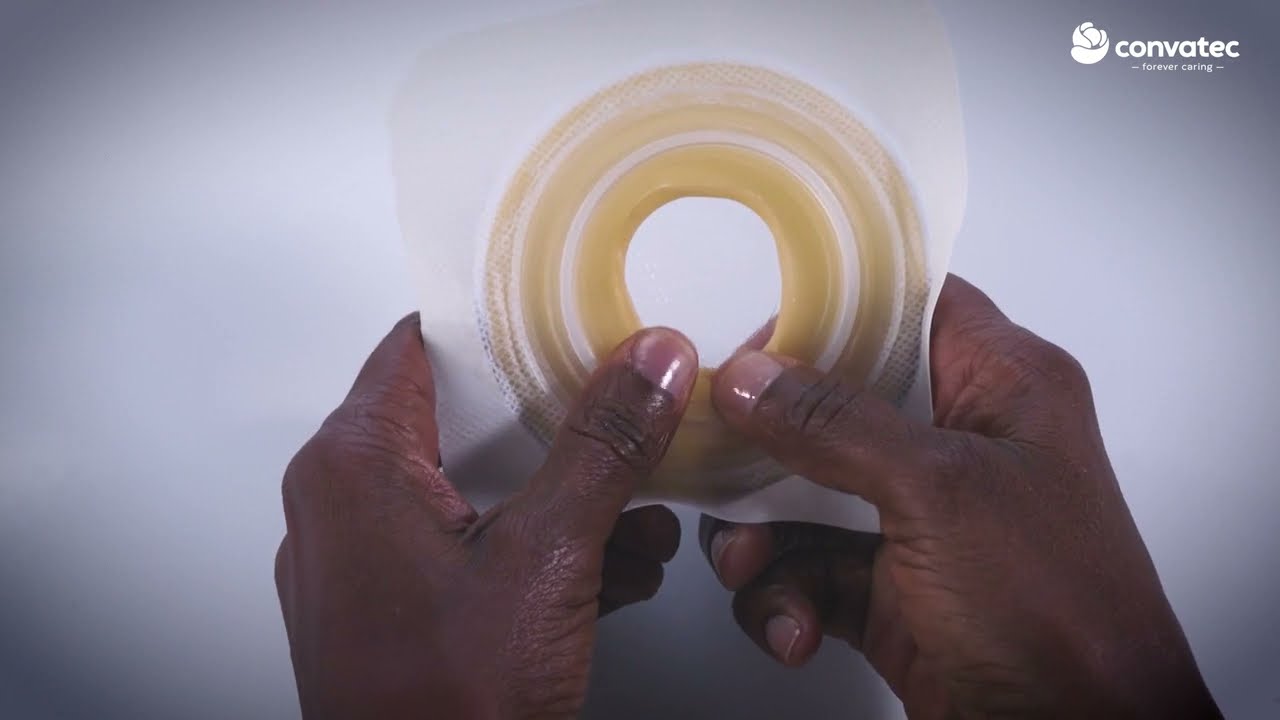 How to Apply a Convatec Two-piece Mouldable Stoma Pouching System