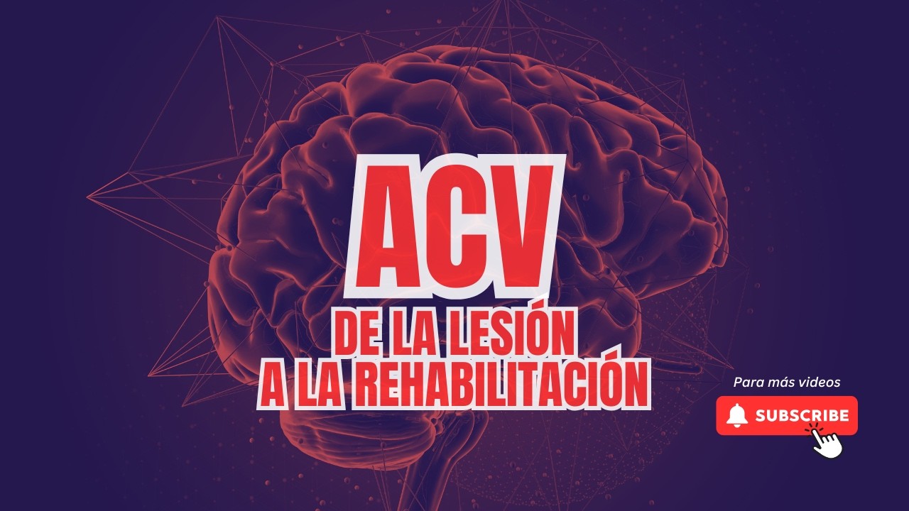 TODO lo que TIENES QUE SABER sobre ACV en CHILE