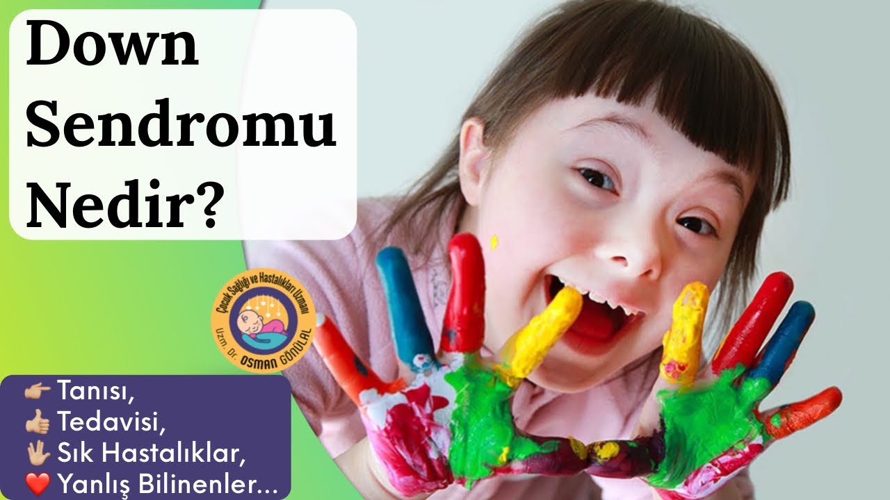 Down Sendromu İle Yaşamak (Sebebi, Risk Faktörleri, Tanı, Tedavi, İzlem...)