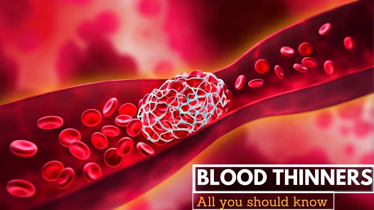 Blood Thinners, Everything You Need to Know