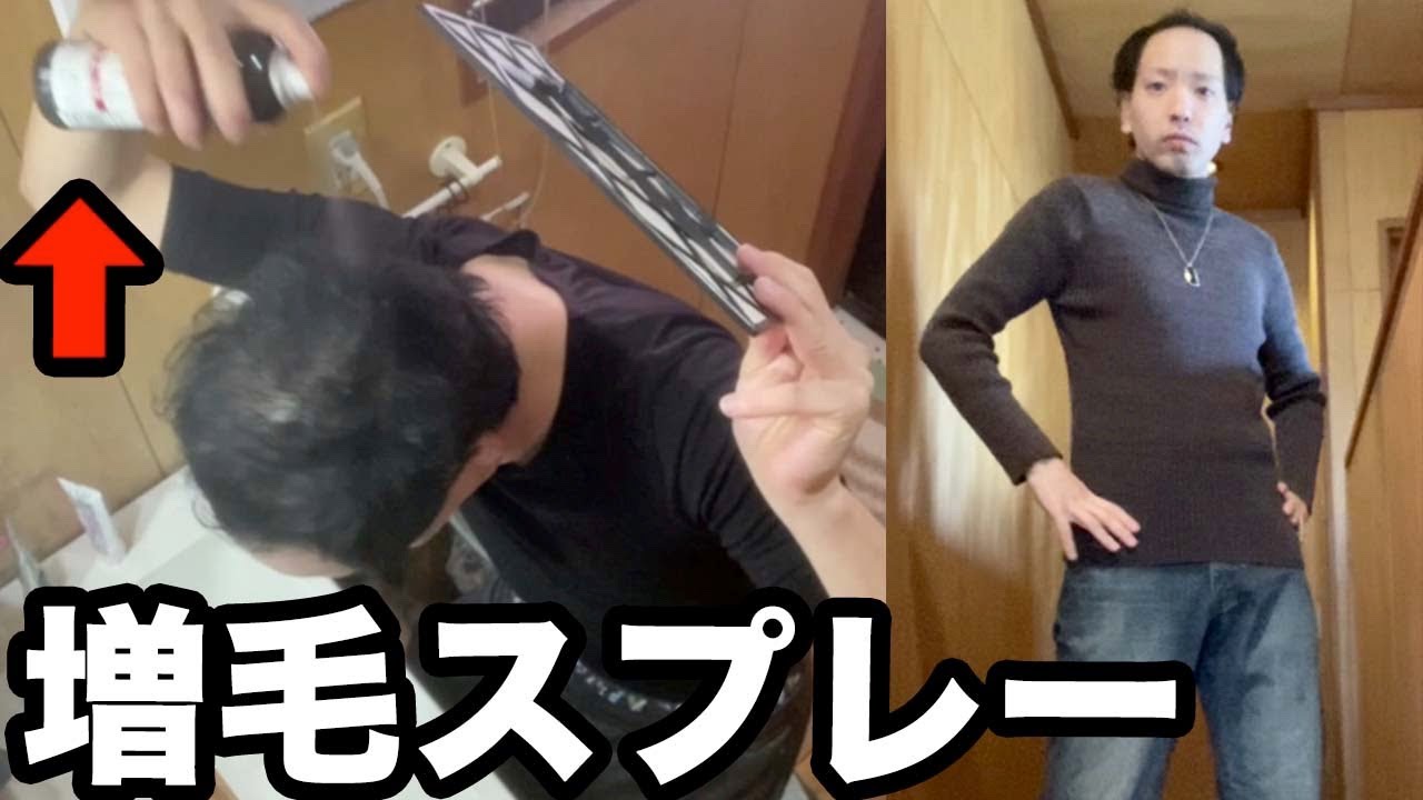若ハゲが増毛スプレーとファッションで、がちイケメンになってみた