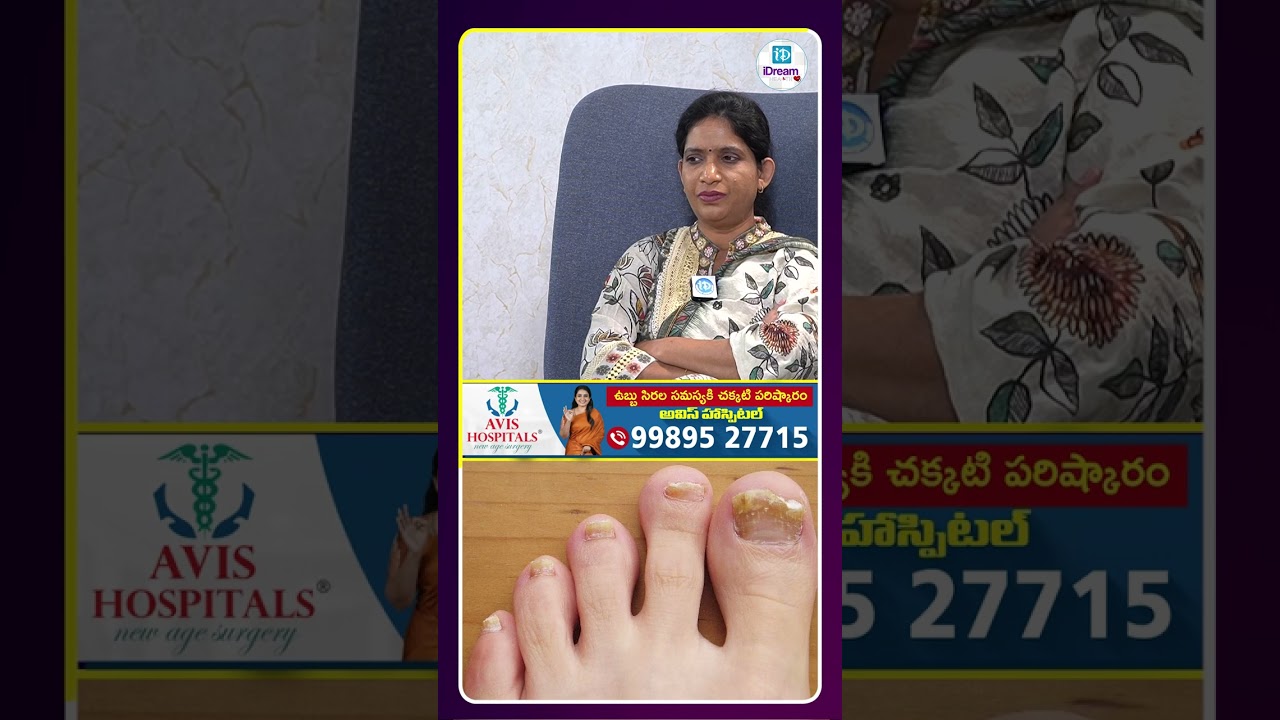 కొబ్బరి,నువ్వులు తీసుకుంటే గోర్లు పుచ్చిపోకుండా ఉంటాయి | iDream Health