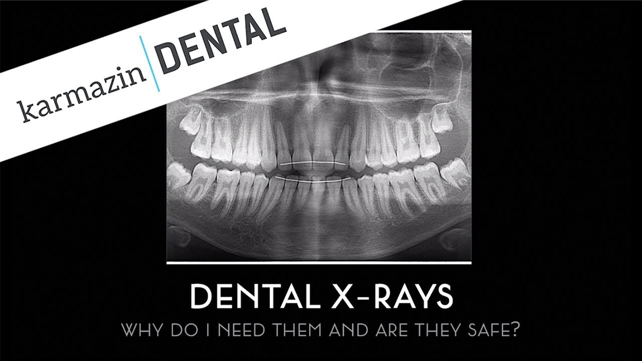 Dental X-Rays: Are They Safe? And Why Do You Need Them?