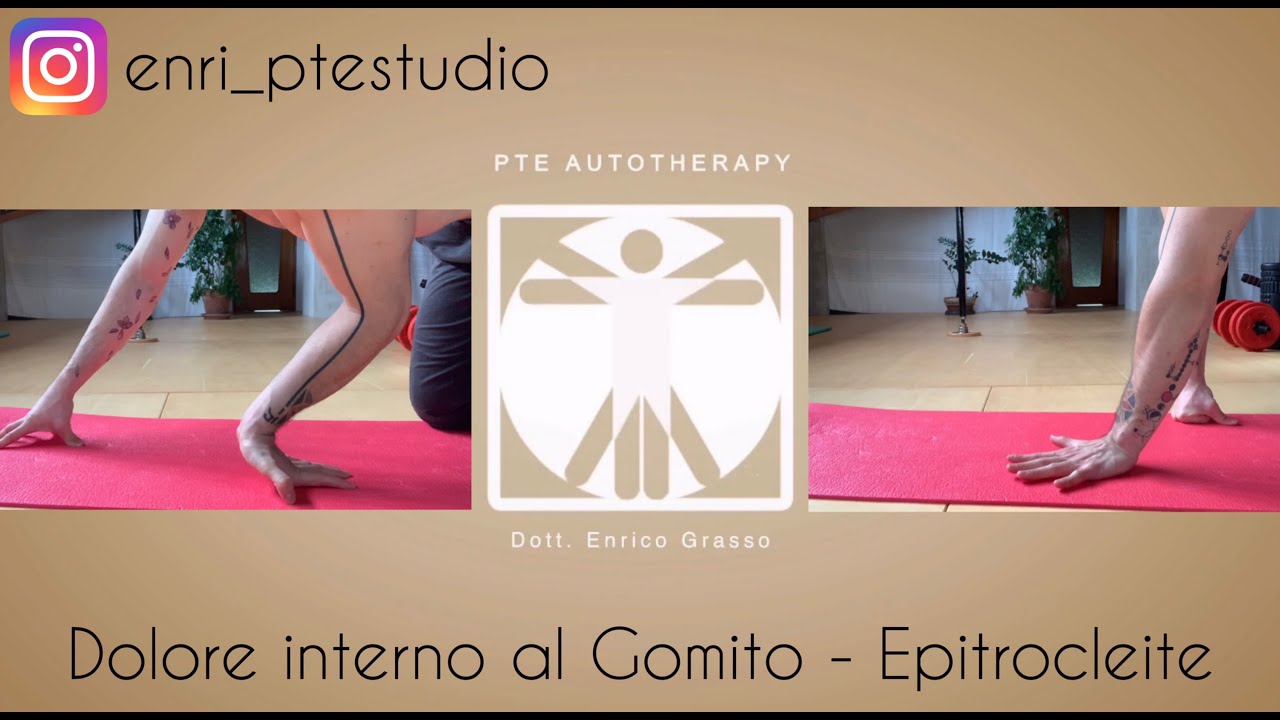 Dolore al Gomito - Epicondilite Mediale (Epitrocletite)
