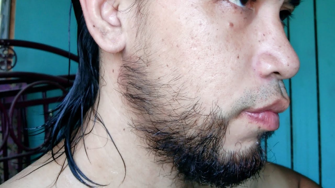 Brewok Minoxidil...hanya guna sebotol, hasilnya mantap