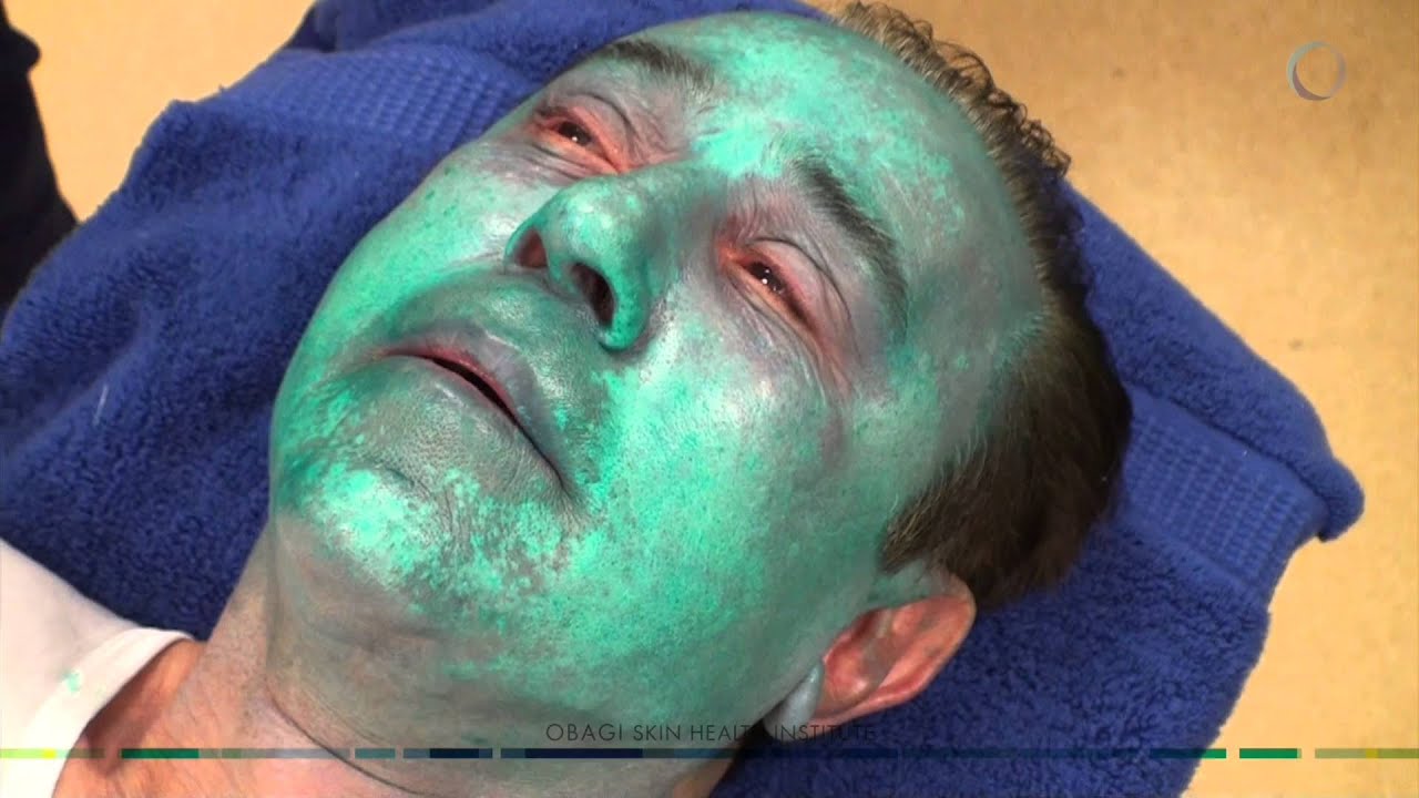 Dr. Zein Obagi is Having a Peel