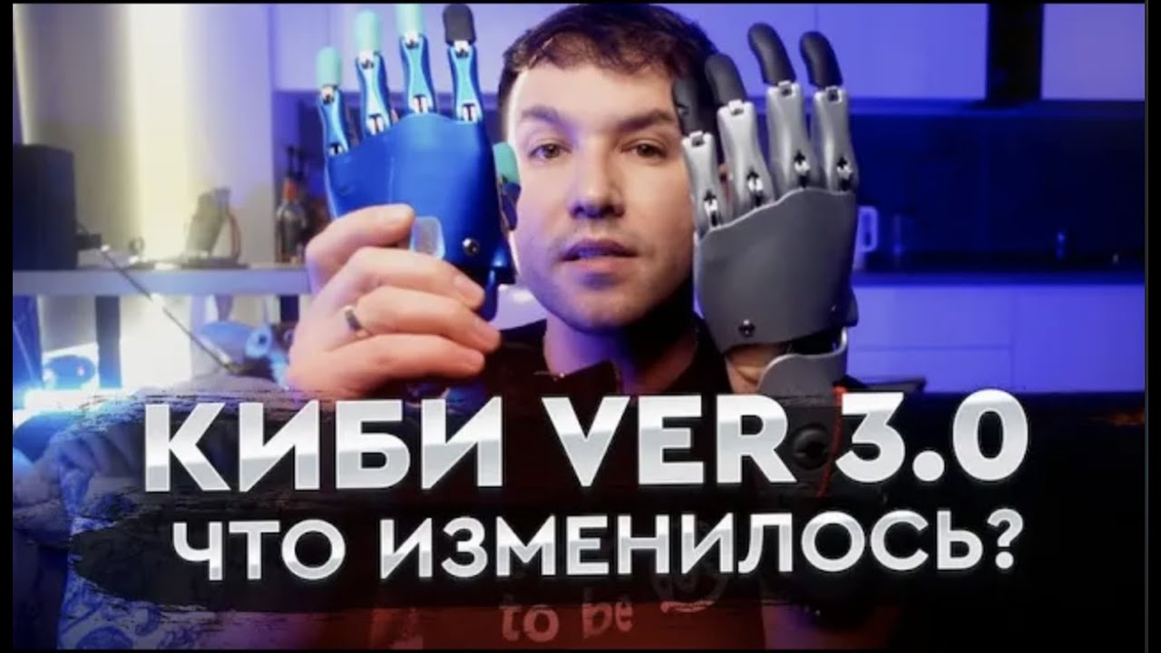 Протез руки! Новая версия, что же там придумали в Сколково