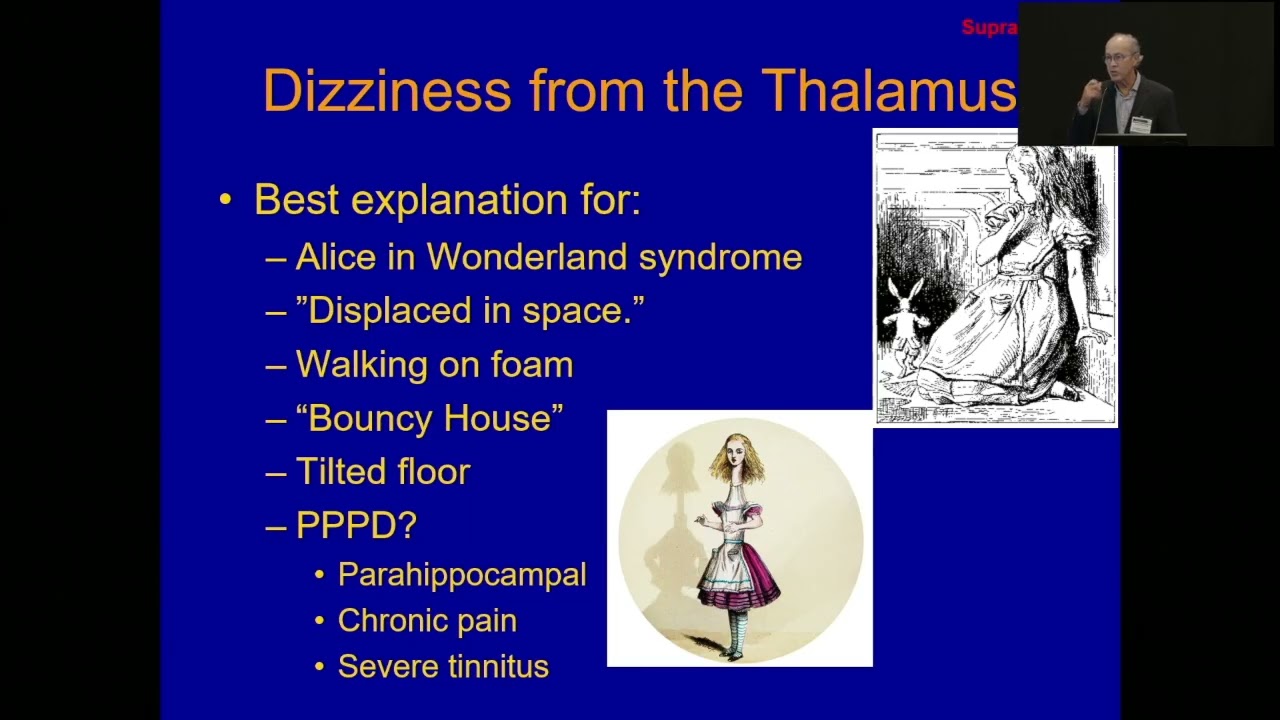 Chronic Vertigo and Dizziness:  Unraveling Vestibular Migraine Mechanisms