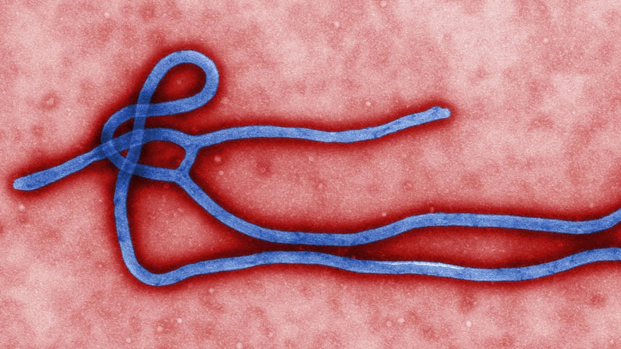 Top 5 Incurable Diseases