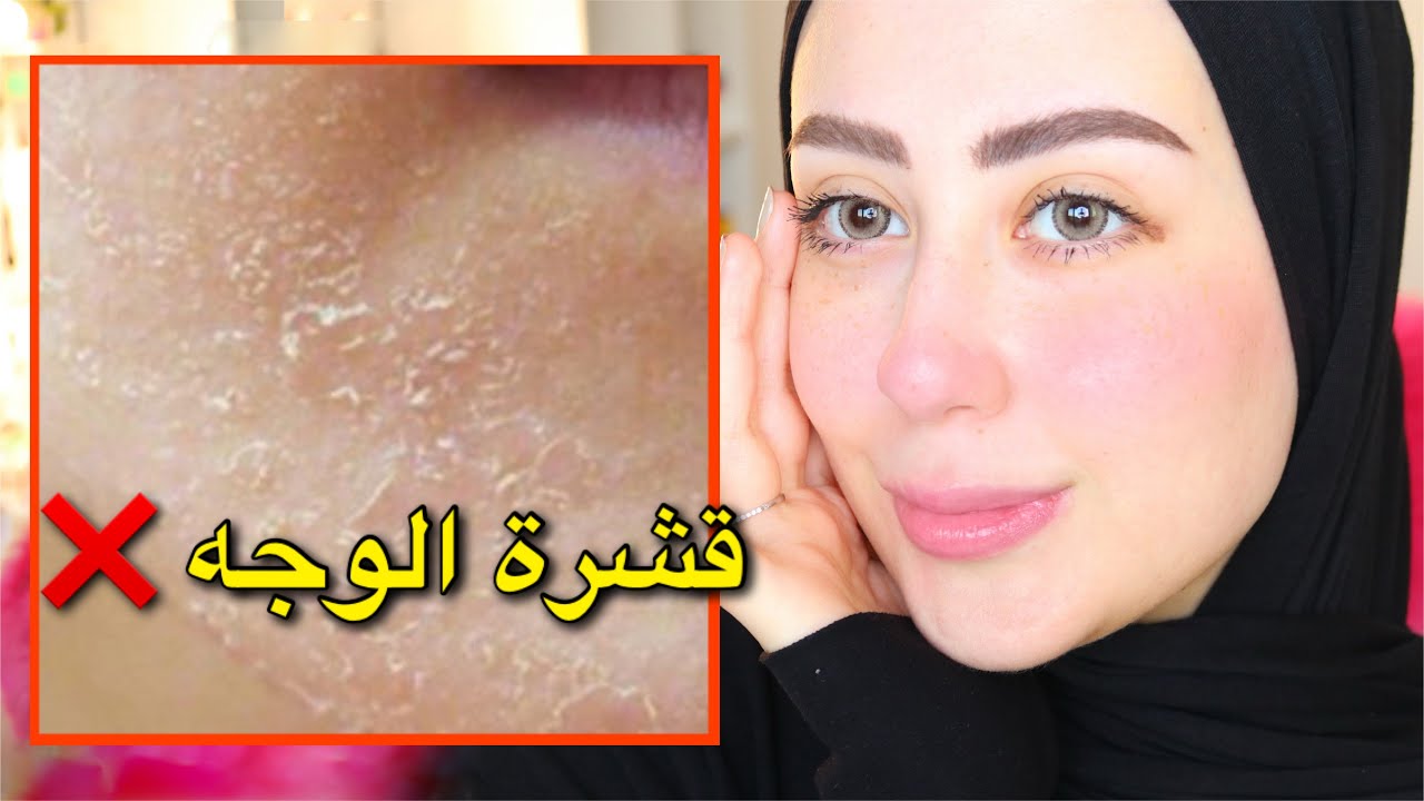 طريقه التخلص من قشرة الوجه نهائيا 😍|| شهد ناصر 🌸
