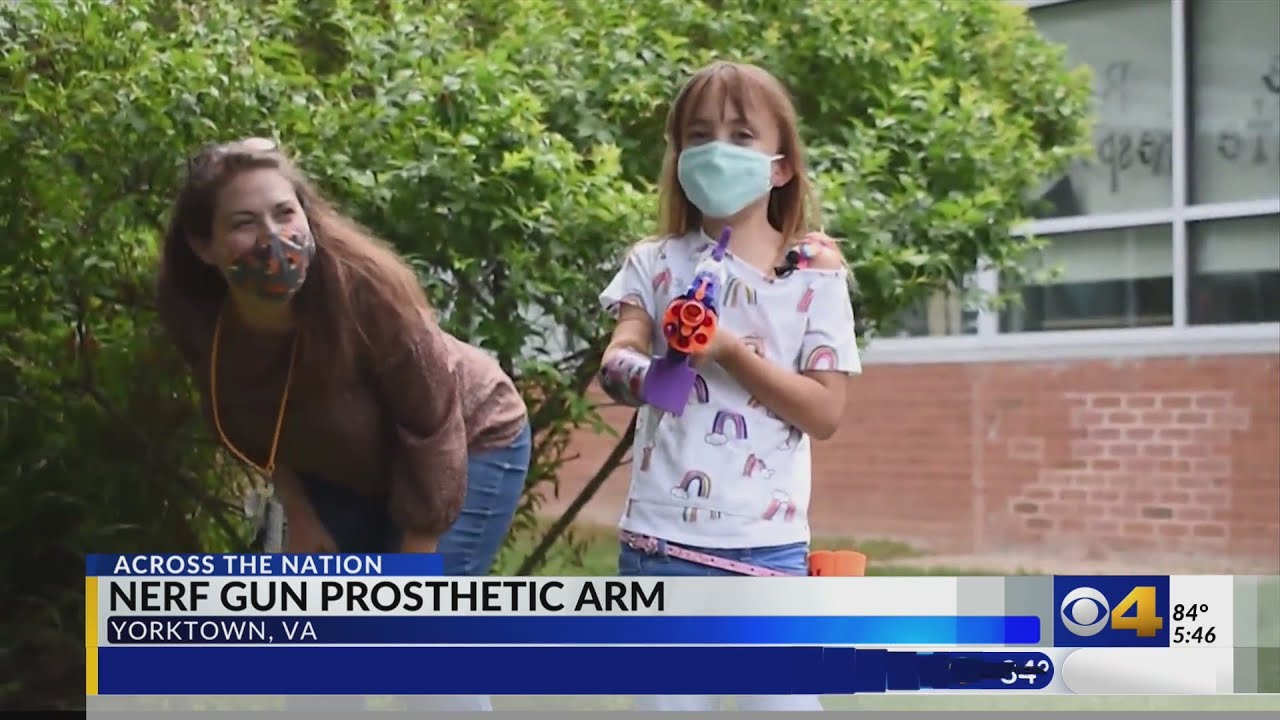 Virginia girl has Nerf gun prosthetic arm