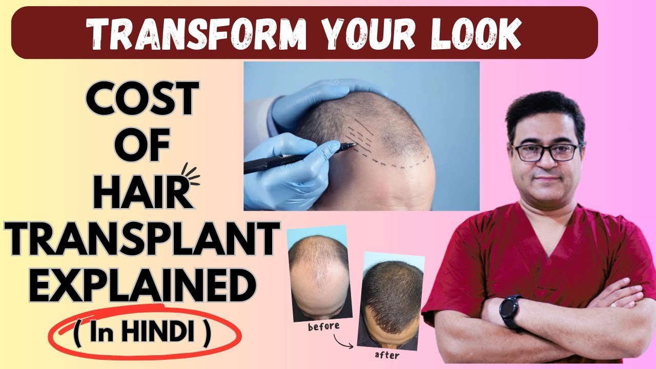 Cost of Hair Transplant Chandigarh India |  World's Best technology for hair transplant in 2023.