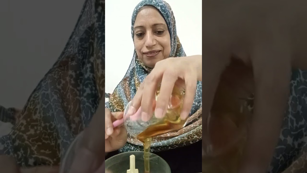 كل الي كان شوفني من زميالي يقولي كيف عالجت الكلف الي كان وجهك ؟؟  معقول عرفتي تعالجيه في المنزل